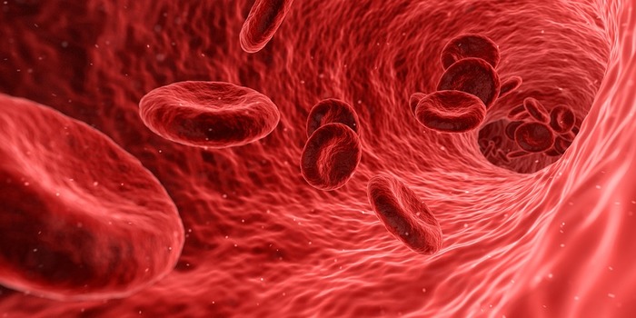수술 중 DVT 공압 압박 펌프 혈류정체 차단
